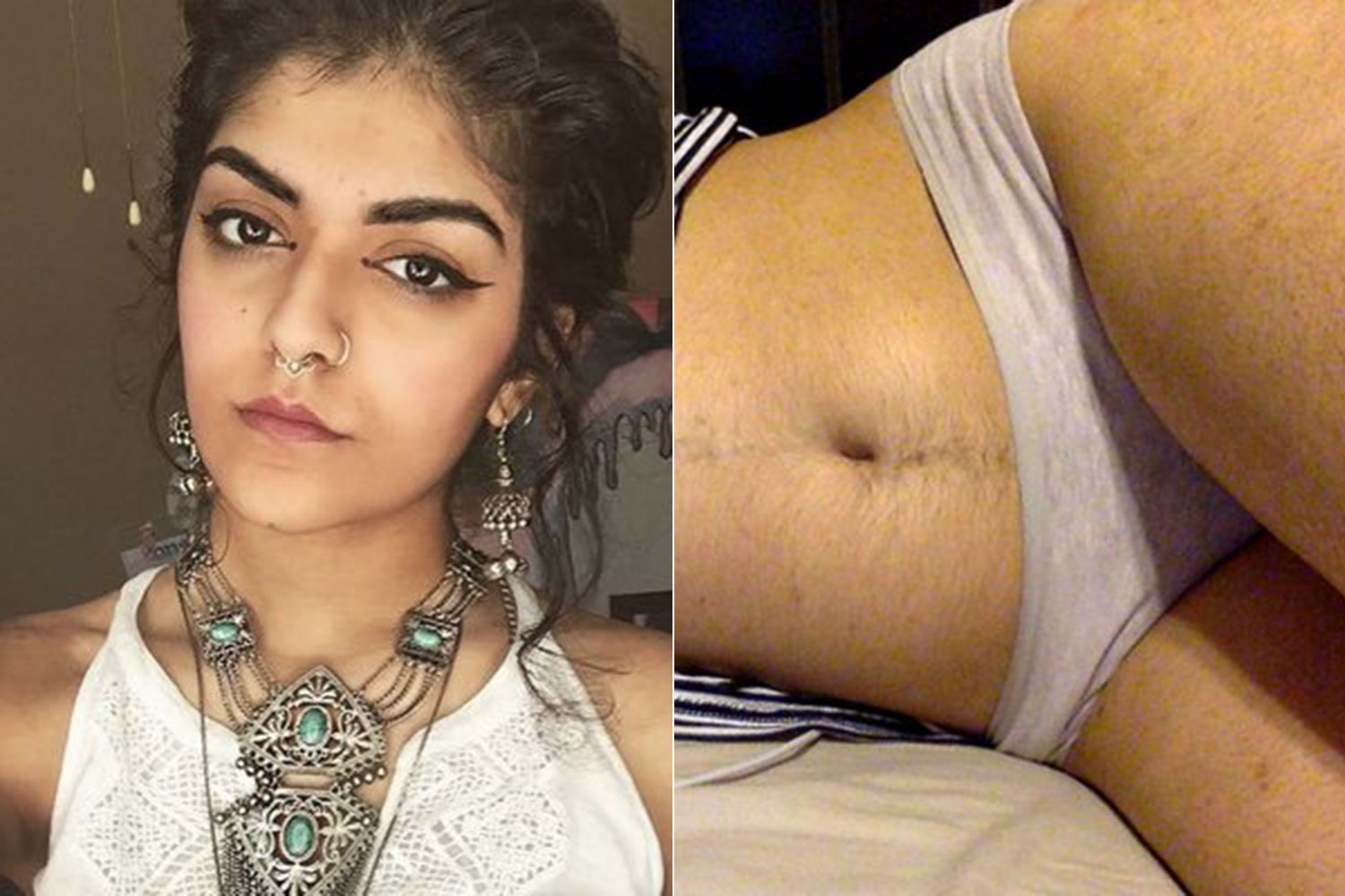Woman shares pictures of her hairy stomach online and shuts down body shame...